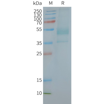 Human CXCR2 full length protein-synthetic nanodisc
