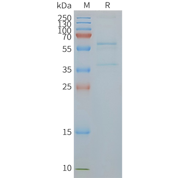 Human SLC2A4 full length protein-synthetic nanodisc
