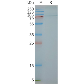 Human FSHR full length protein-synthetic nanodisc