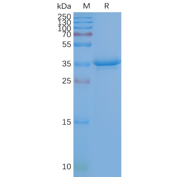 Human CD20 full length protein-synthetic nanodisc