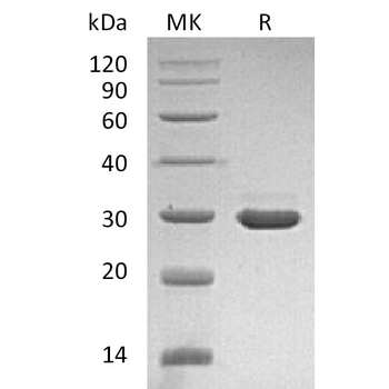 Human FSTL1 Protein, His Tag