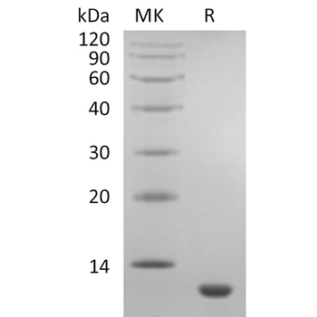 Human FGF19 Protein, His Tag
