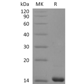 Human FCGR3B Protein, hFc Tag