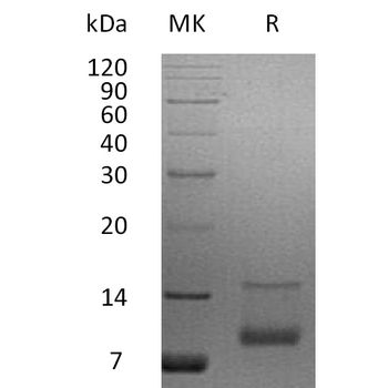 Human IGHE Protein, His Tag