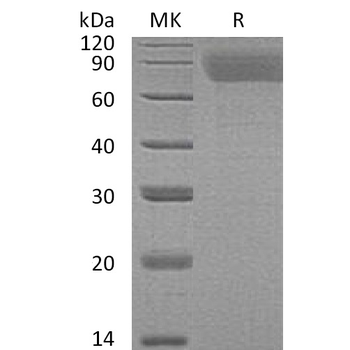 Human GPNMB Protein, His Tag