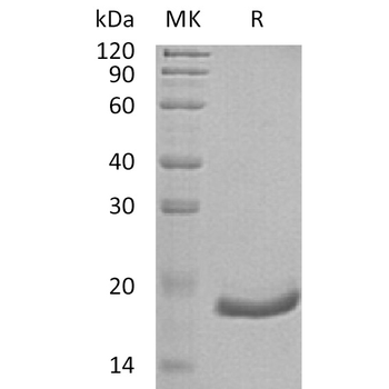 Human KREMEN2 Protein, His Tag
