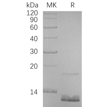 Human LY6H Protein, hFc Tag