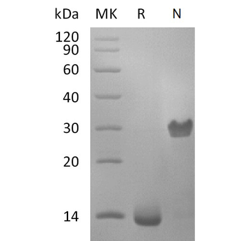 Human IL20RA Protein, hFc Tag