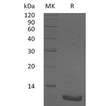 Human DKK1 Protein, mFc Tag