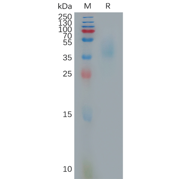 Human LYPD3(31-325) Protein, His Tag