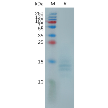 Human LYPD3(31-286) Protein, His Tag