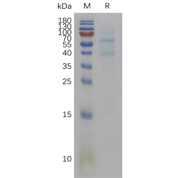 Human ANGPTL7 Protein, His Tag
