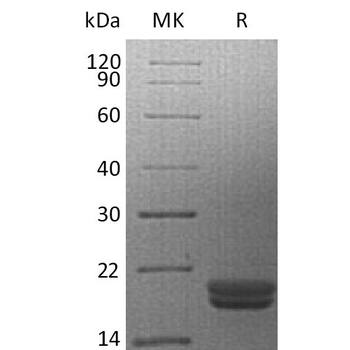 Human IL23A and IL12B Heterodimer Protein, hFc Tag and His Tag