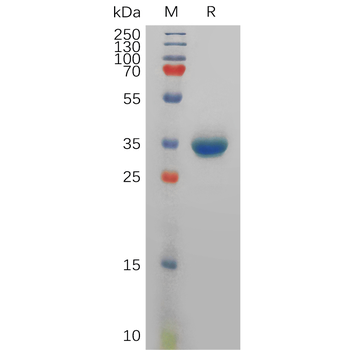 Human BTN2A1 Protein, His Tag