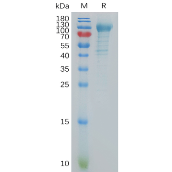 Human CADM1 Protein, His Tag