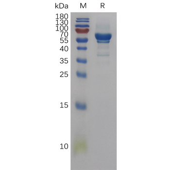 Human CLEC1B Protein, His Tag