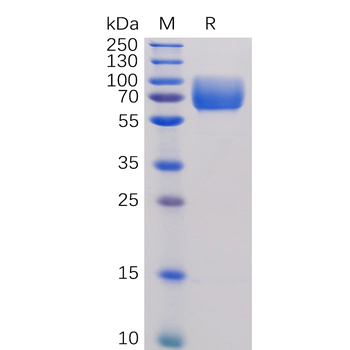 Human TNFRSF1B Protein, hFc Tag