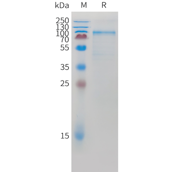 Cynomolgus B7-H6 Protein, His Tag