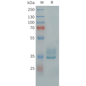 Cynomolgus 4-1BB Protein, hFc Tag