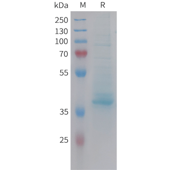 Cynomolgus PD-L1 Protein, His Tag