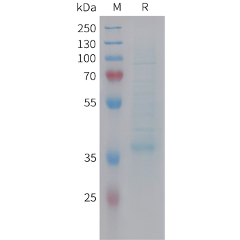 Cynomolgus 5T4 Protein, His Tag
