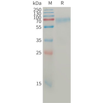 Human BCMA(1-42) Protein, mFc Tag