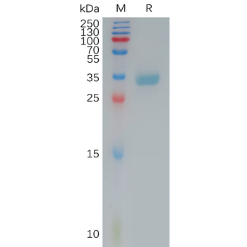 Human MFAP4 Protein, His Tag