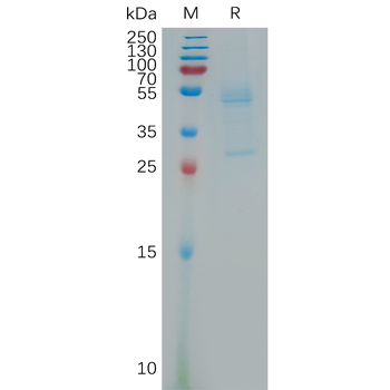 Human RTN4R Protein, His Tag