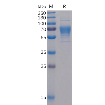 Human CDH17(567-667) Protein, hFc Tag