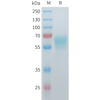 Mouse CXADR Protein, His Tag