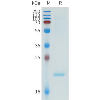 Mouse CD45 Protein, His Tag