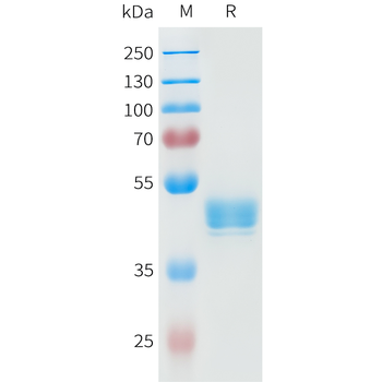 Mouse B7-H4 Protein, His Tag