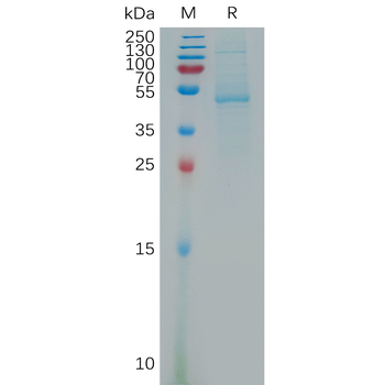 Human IGF1 Protein, hFc Tag
