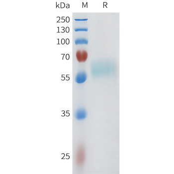 Mouse TFRC Protein, His Tag