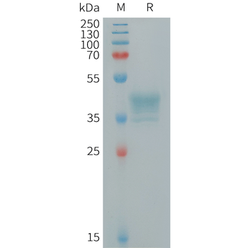 Human CCL3 Protein, hFc Tag