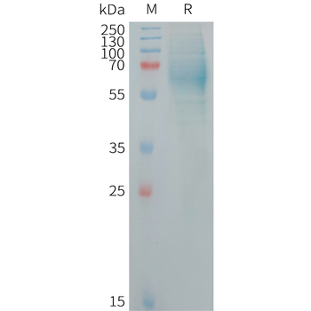 Human CCL5 Protein, hFc Tag