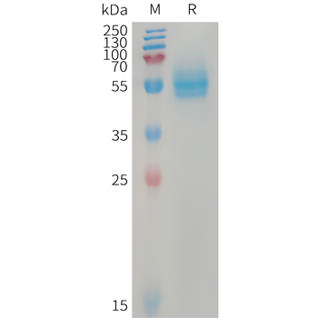 Human DR6 Protein, His Tag