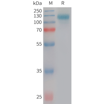 Human CD28 Protein, His Tag