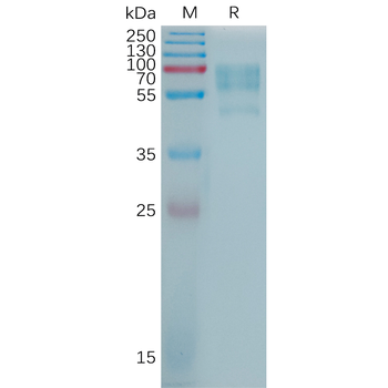 Human TNFRSF6 Protein, hFc Tag