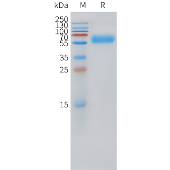 Feline IL31 Protein, His Tag