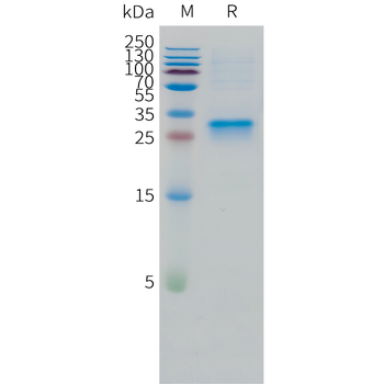 Cynomolgus CDCP1 Protein, His Tag