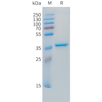 Cynomolgus CRTAM Protein, His Tag