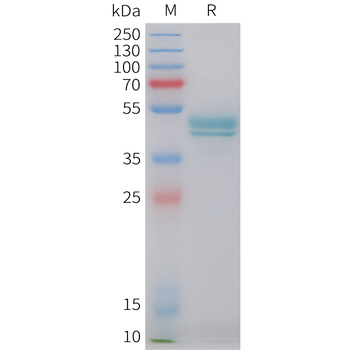 Cynomolgus FCRL5 Protein, His Tag