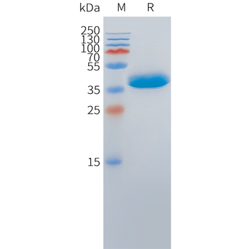 Cynomolgus CD3D Protein, His Tag