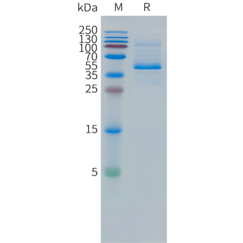 Cynomolgus FAP Protein, His Tag