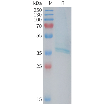 Human AXL(332-451) Protein, hFc Tag