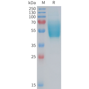 Human AXL(223-335) Protein, hFc Tag