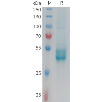Human FCGR1A Protein, hFc Tag