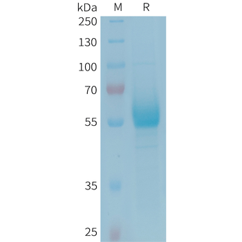 Human CD19(M75V,R76S,F85S) Protein, hFc Tag