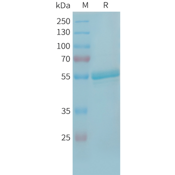 Human CD19(M75I,L82V,F83L) Protein, hFc Tag